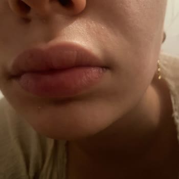 Murat Tezcan Estetik Estetik İşlemlerle İlgili Tarafsız Değerlendirme