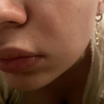 Murat Tezcan Estetik Estetik İşlemlerle İlgili Tarafsız Değerlendirme