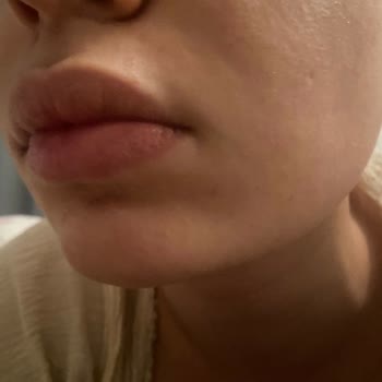 Murat Tezcan Estetik Estetik İşlemlerle İlgili Tarafsız Değerlendirme