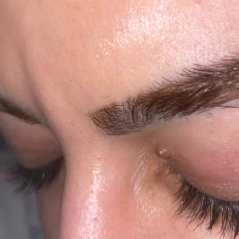 Murat Tezcan Estetik Estetik İşlemlerle İlgili Tarafsız Değerlendirme