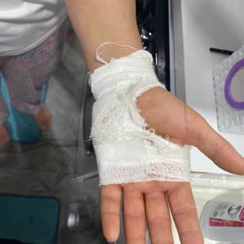 Cıngıllıoğlu Madeni Eşya Cıngıllıoğlu Merdiven Sorumluluğunu Üstlenmiyor