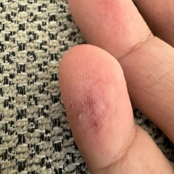 Martı Scooter Sözde Kırmızı Park Yasağı Alanı!