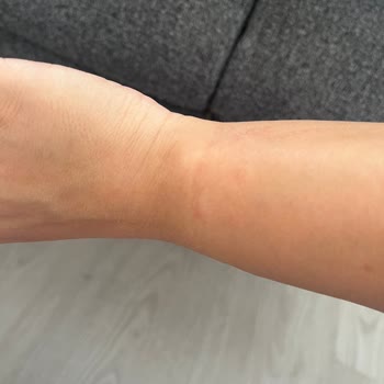 Atelier Duygu 3MM Su Yolu Bileklik Alerji Yaptı