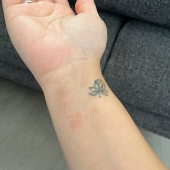 Atelier Duygu 3MM Su Yolu Bileklik Alerji Yaptı