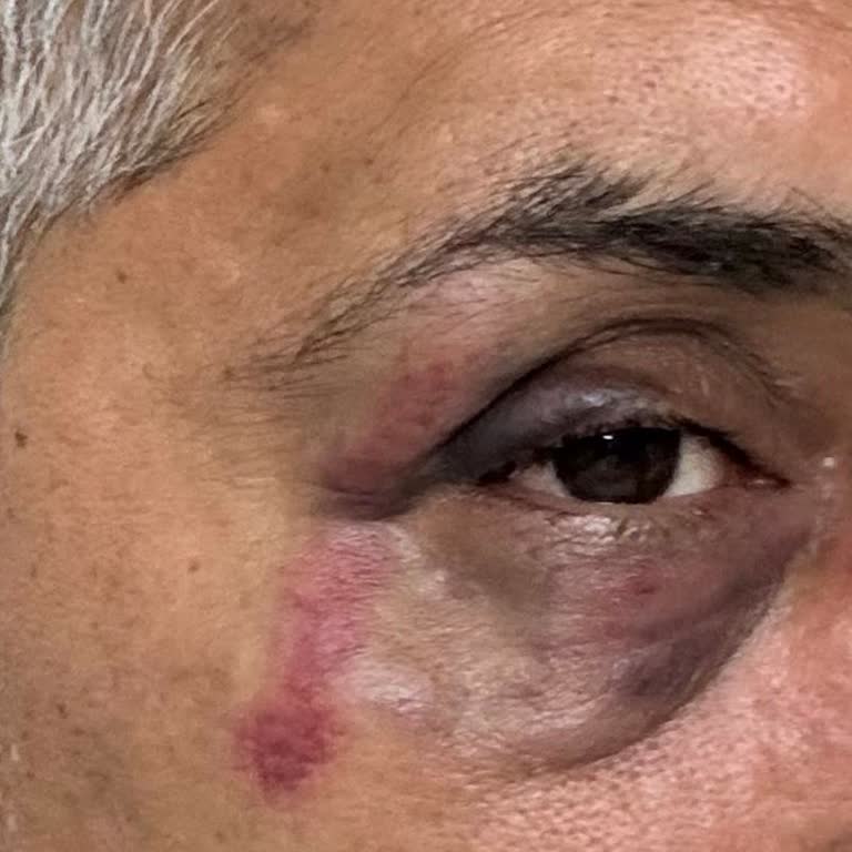 Yemeksepeti Kuryelerinizin Tehdit Ve Saldırıları Hakkında Şikayet