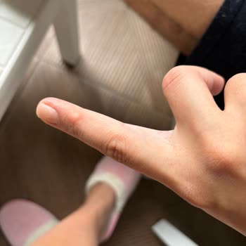 Dyson Dayson V8 Kullanımında Parmağımda Nasır Oluştu