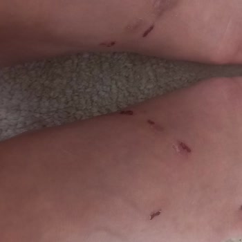 Greyder Terlikleri Ayağımı Yara Yapıyor Ve Değişim Kabul Edilmiyor