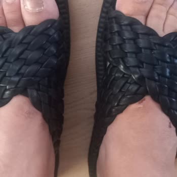 Greyder Terlikleri Ayağımı Yara Yapıyor Ve Değişim Kabul Edilmiyor