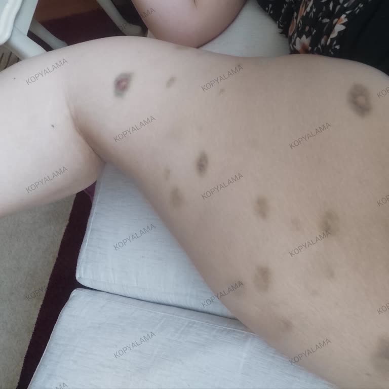 Banu Parlak Güzellik Merkezi Avcılar'daki Şube Sorunları Ve Müşteri Memnuniyetsizliği