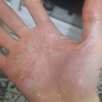 Ekuralkan Motosikletin Sağlık Ve Kalite Sorunlarıyla Mücadelem!