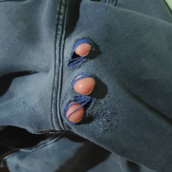 Lacoste Pantolon Çok Kısa Sürede Deforme Oldu