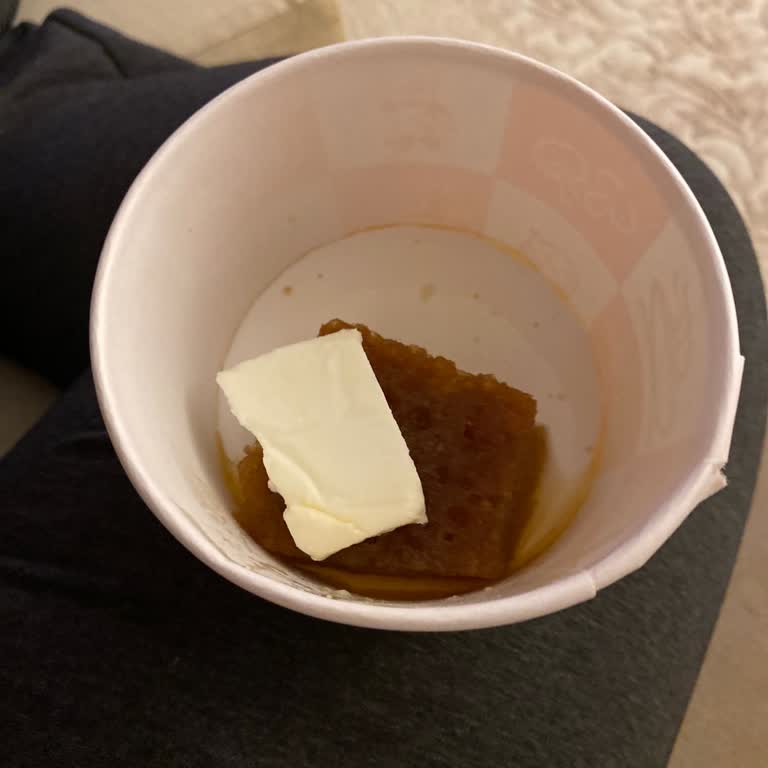 Köfteci Yusuf Trendyol Üzerinden Verilen Siparişte Eksiklik Ve Dikkatsizlik