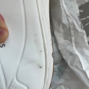 Amazon'dan Aldığım Skechers Marka Ayakkabılar Kısa Sürede Deforme Oldu