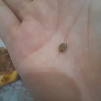 Usta Pideci'de Yanlış Sipariş Ve Taşa Benzer Sert Bir Şey Çıktı