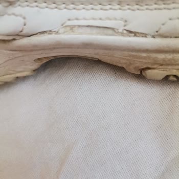 Skechers Ayakkabı 5 Ayda Açıldı Kalitesiz Ürün