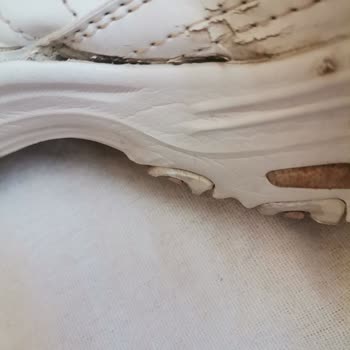 Skechers Ayakkabı 5 Ayda Açıldı Kalitesiz Ürün