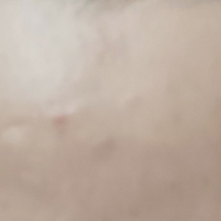 Yves Rocher Ürünleri Sivilce Yapıyor