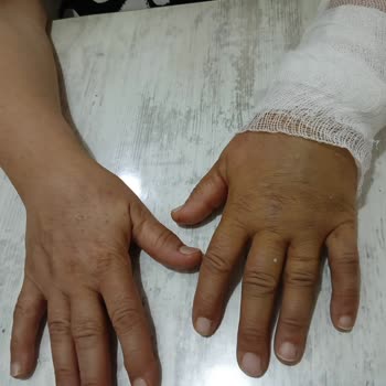 Şehit Sait Ertürk Devlet Hastanesi Pansuman Yapan Kişi Umarım Okur