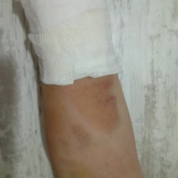 Şehit Sait Ertürk Devlet Hastanesi Pansuman Yapan Kişi Umarım Okur