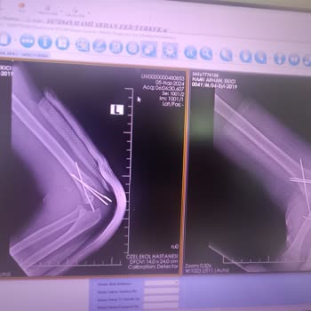 Gagapagos Çocuğumun Güvenliği İçin Tehlikeli Oyun Alanı Deneyimi