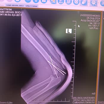 Gagapagos Çocuğumun Güvenliği İçin Tehlikeli Oyun Alanı Deneyimi