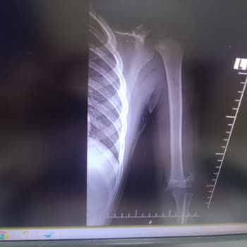 Gagapagos Çocuğumun Güvenliği İçin Tehlikeli Oyun Alanı Deneyimi