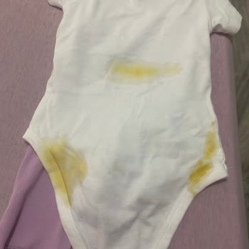 Prima Premium Care'de Kalite Sorunu Ve Sızıntı Problemi