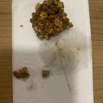 Nestlé Nesfit Tam Tahıllı Bar Ürünü Hakkında Şikayet