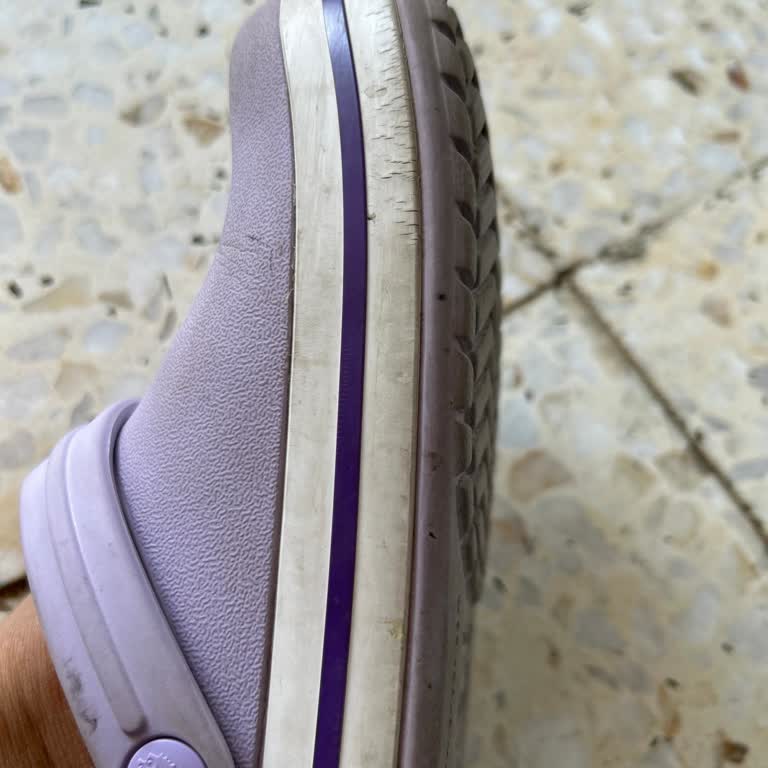 Crocs Terlik & Ayakkabı Terliğimde Açılma Sorunu