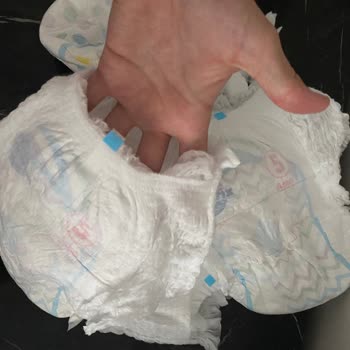 Molfix Külot Bez Paketten Defolu Çıktı