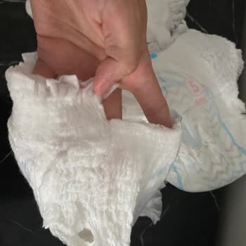 Molfix Külot Bez Paketten Defolu Çıktı