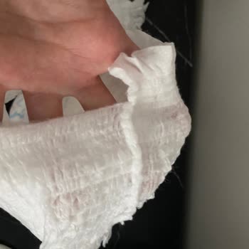 Molfix Külot Bez Paketten Defolu Çıktı