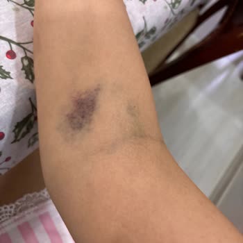 Altunizade Acıbadem Hastanesi Acilde Yaşadıklarım