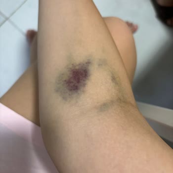 Altunizade Acıbadem Hastanesi Acilde Yaşadıklarım