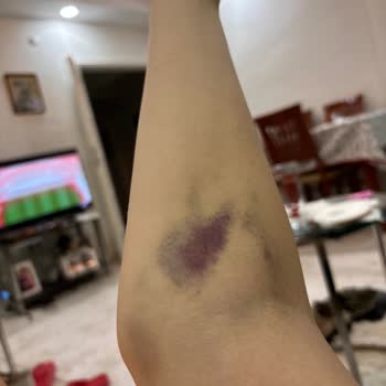 Altunizade Acıbadem Hastanesi Acilde Yaşadıklarım