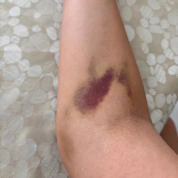 Altunizade Acıbadem Hastanesi Acilde Yaşadıklarım