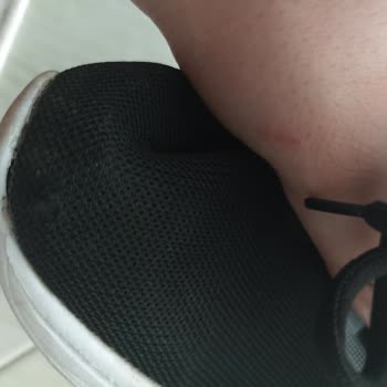 Hepsiburada Garantisi Olan Ayakkabının Onarım Talebini Reddetti