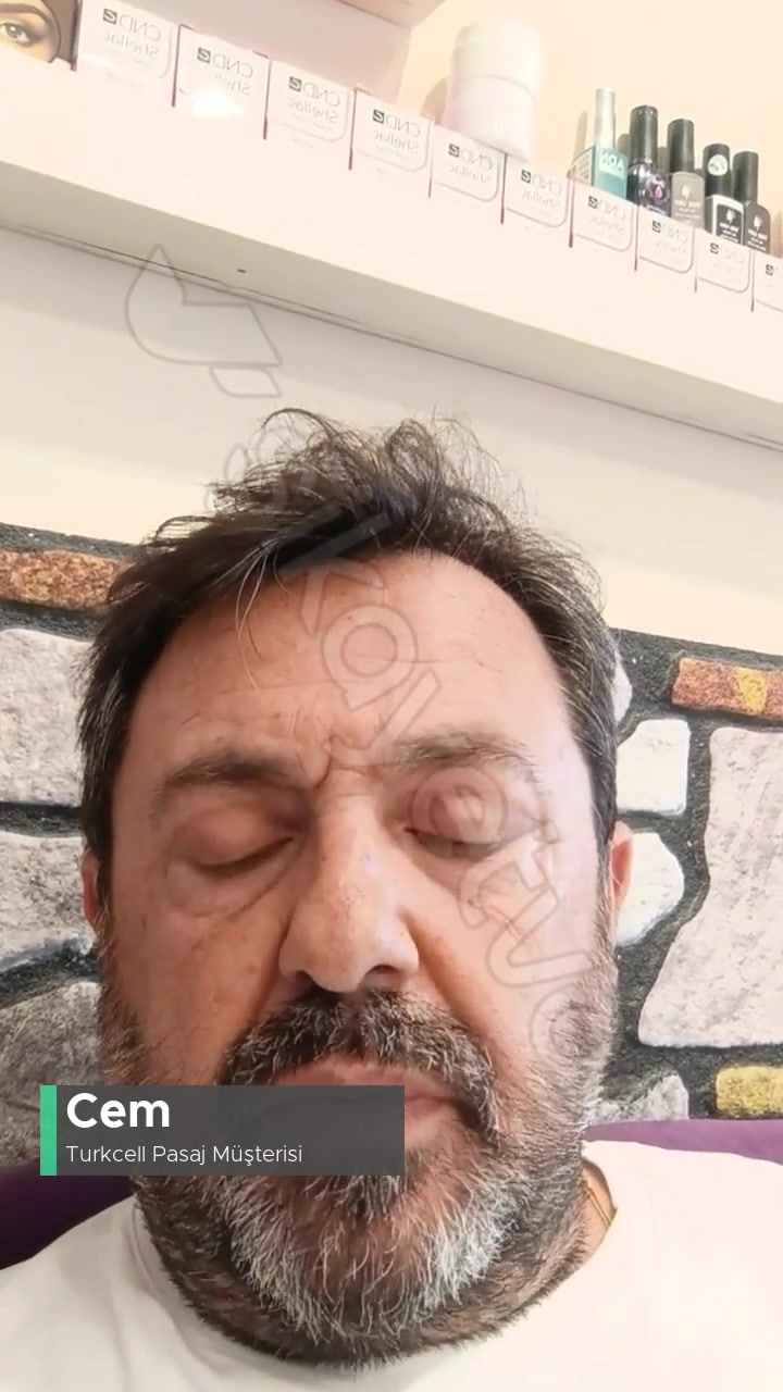 Turkcell Pasaj Mağduriyeti Servis Sorunu videonun kapak resmi