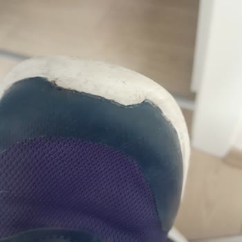 Skechers Markası Asla Kaliteli Değil