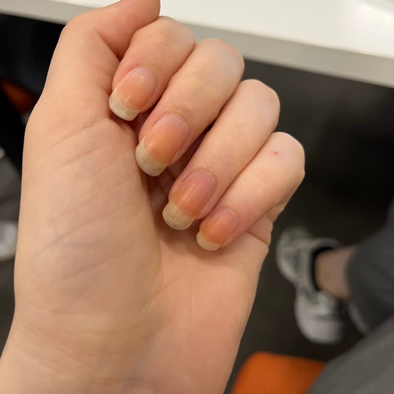 Kiko Milano Kiko Oje Tırnaklarımı Sararttı