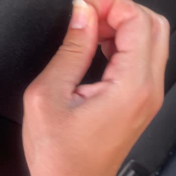 Zeplin Car Rental Zeplin İkame Araç Çirkinliği