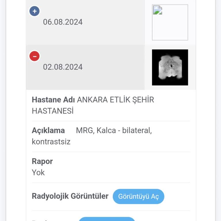 Ankara Etlik Şehir Hastanesi MR Raporu Çıkmadı