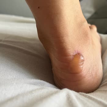 Derimod Müşteri İlgisizliği Şikayeti