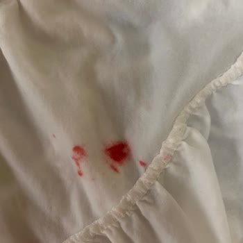 Domestos Kırmızı Leke Yaptı!