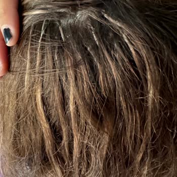 Burhan Eroğlu Medical Kaynak Gerçeği İle Rezil Olmak