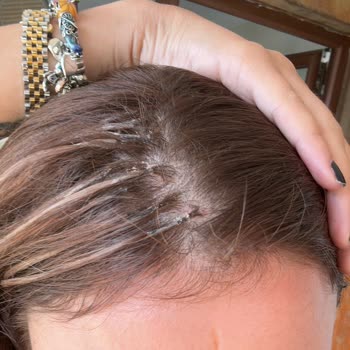 Burhan Eroğlu Medical Kaynak Gerçeği İle Rezil Olmak