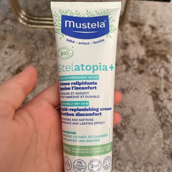 Mustela Stelatopia Cream Caused Severe Redness on My Baby's Face