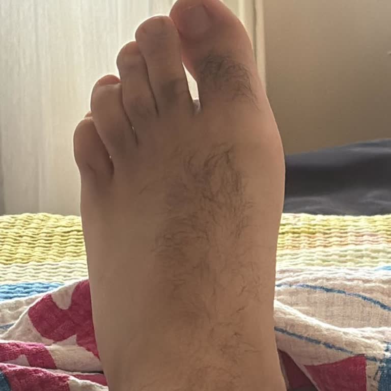 Skechers Ayakkabı Üretim Hatası Nedeniyle Ayak Sağlığım Bozuldu