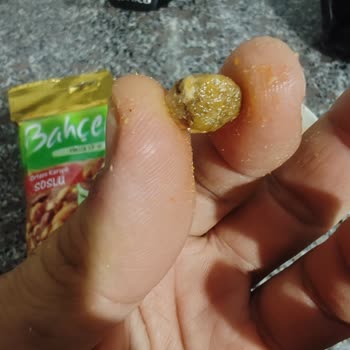 Peyman Bahçeden Ortaya Karışık Soslu Çerez İçinden Soslu Taş Çıkması
