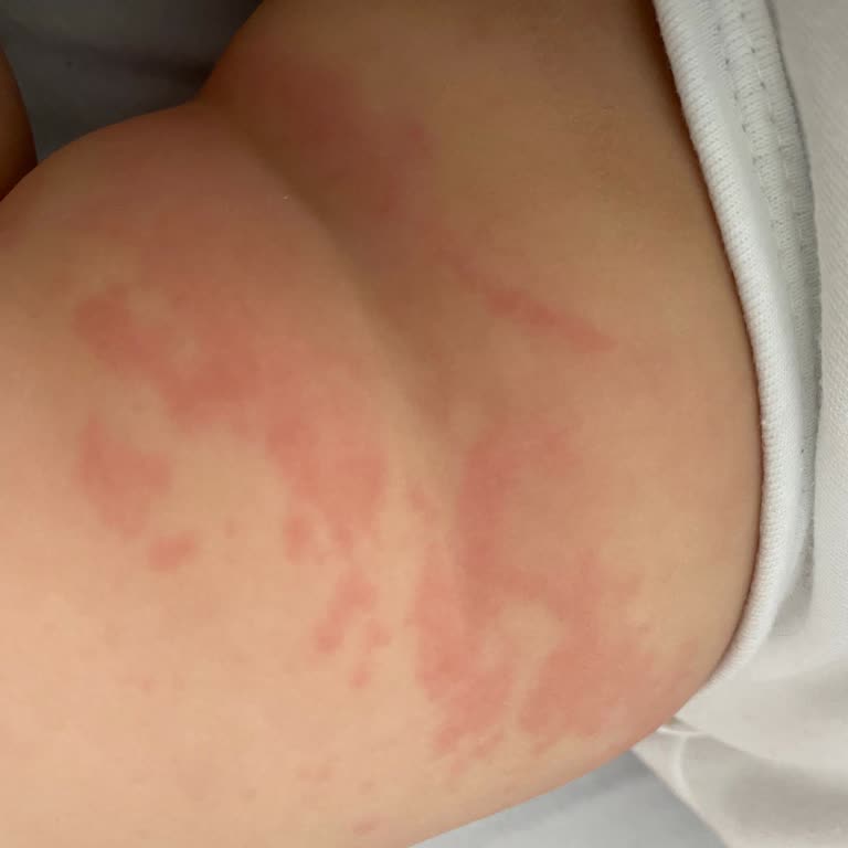 Aptamil De Sorun Var